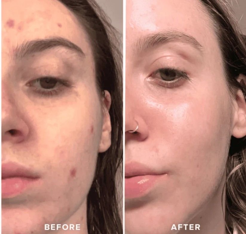 ICE ROLLER - Win Bachat