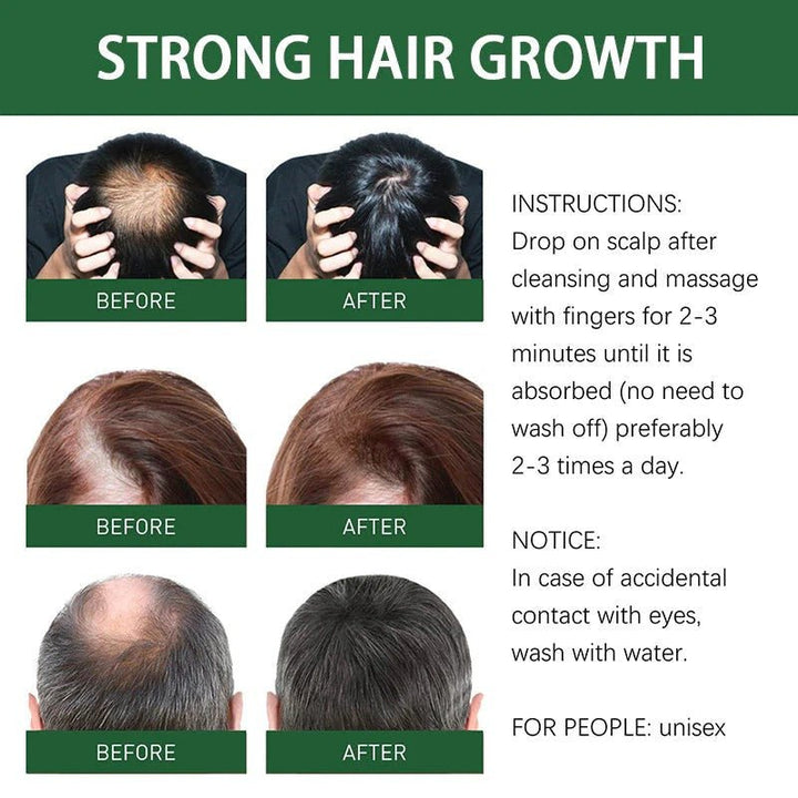 7 Days Hair Grow Serum - Win Bachat