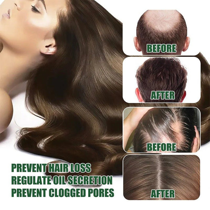 7 Days Hair Grow Serum - Win Bachat