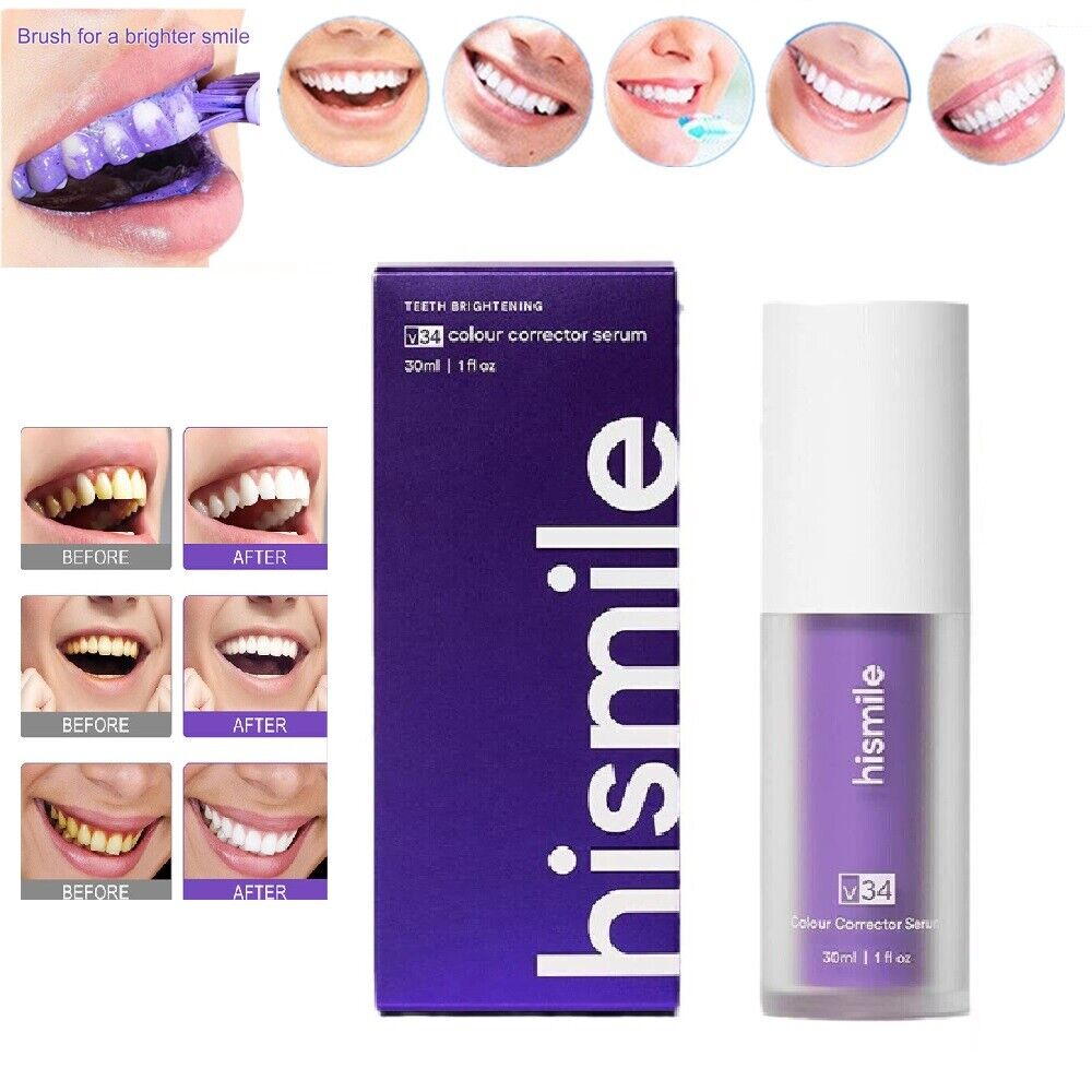 Hismlie teeth whitening - Win Bachat
