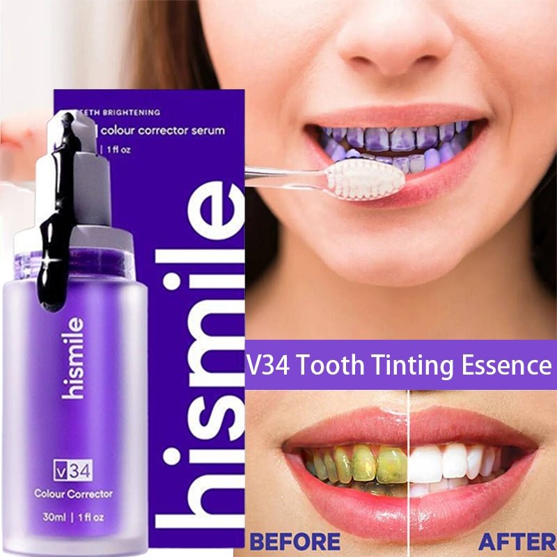 Hismlie teeth whitening - Win Bachat